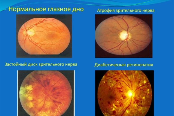 Кракен обход